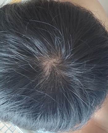 현재