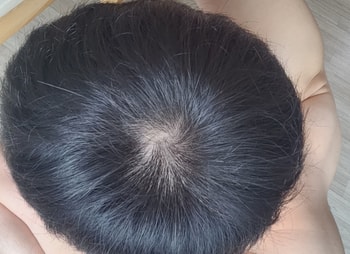 현재