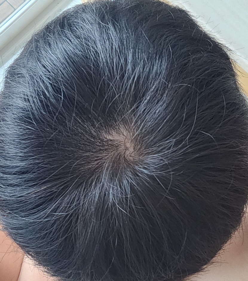 현재