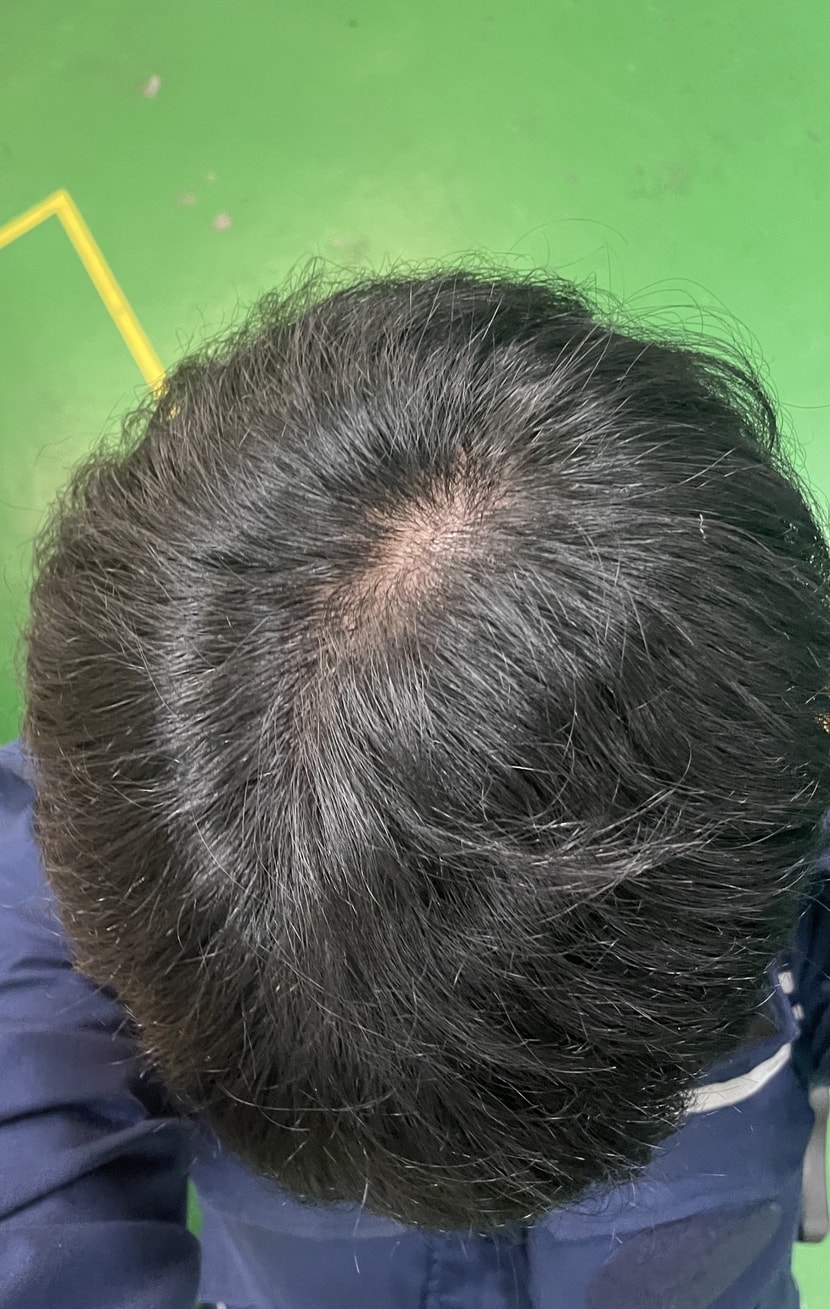 조명 바로 밑입니다