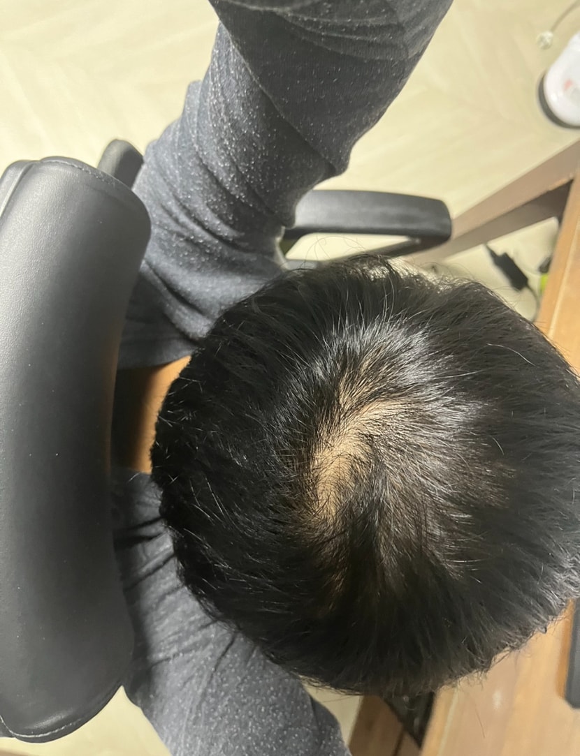 올 2월 정수리