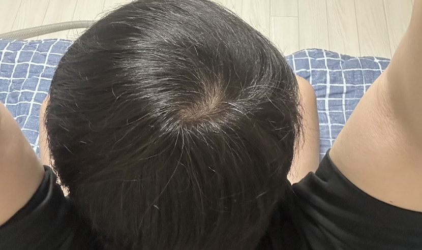 빗으로 머리 가지런히 빗은 머리 1