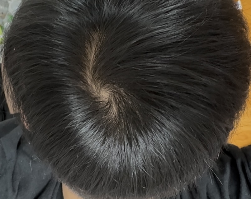 오늘 동영상 캡쳐