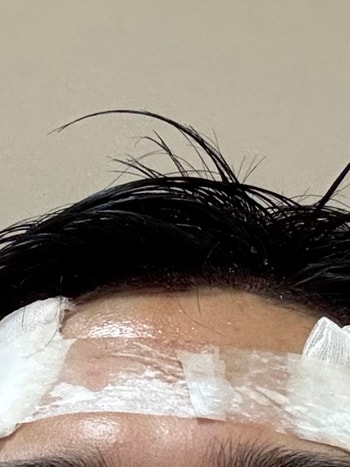 후