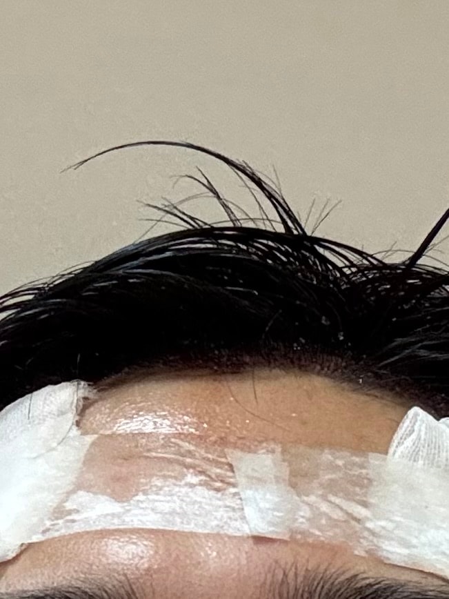 후