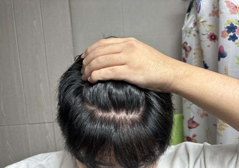 私は豆腐の脱毛みたいですか？ どうか一度だけ見逃してくださればありがたいです..