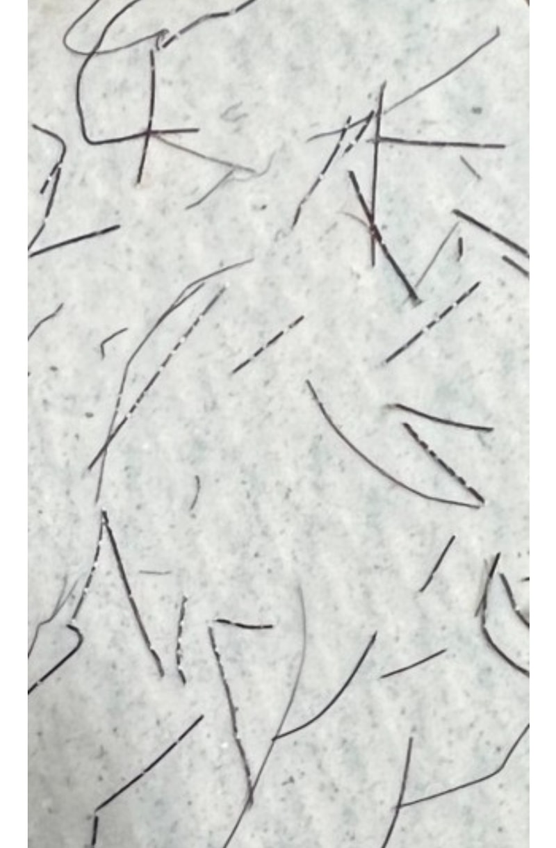 머리카락 흰색 알갱이 끊어짐 꺽임 증상입니다