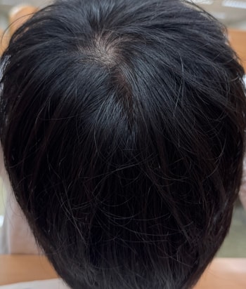덮을 때