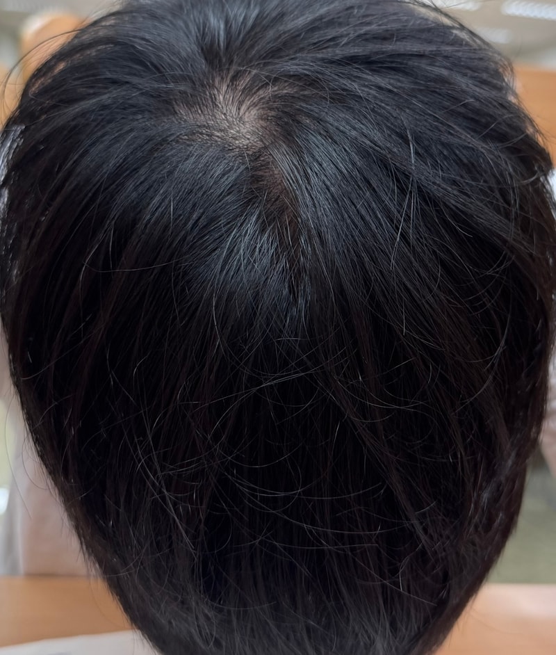 药效不好，副作用越来越严重