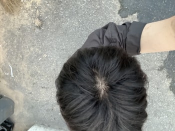 먹은후 야외