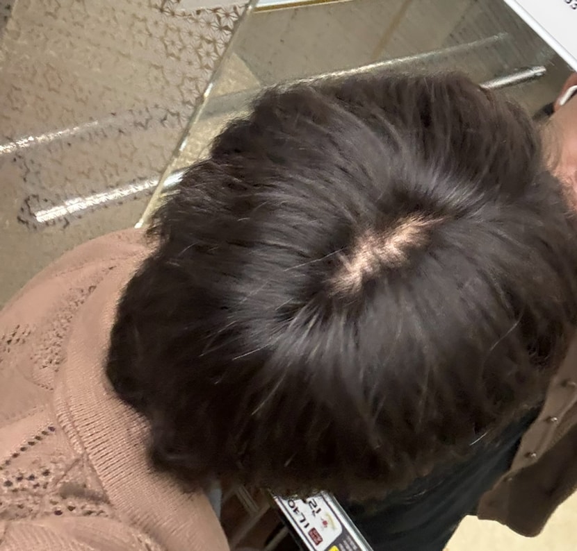 먹은후 같은조명 (1달반)