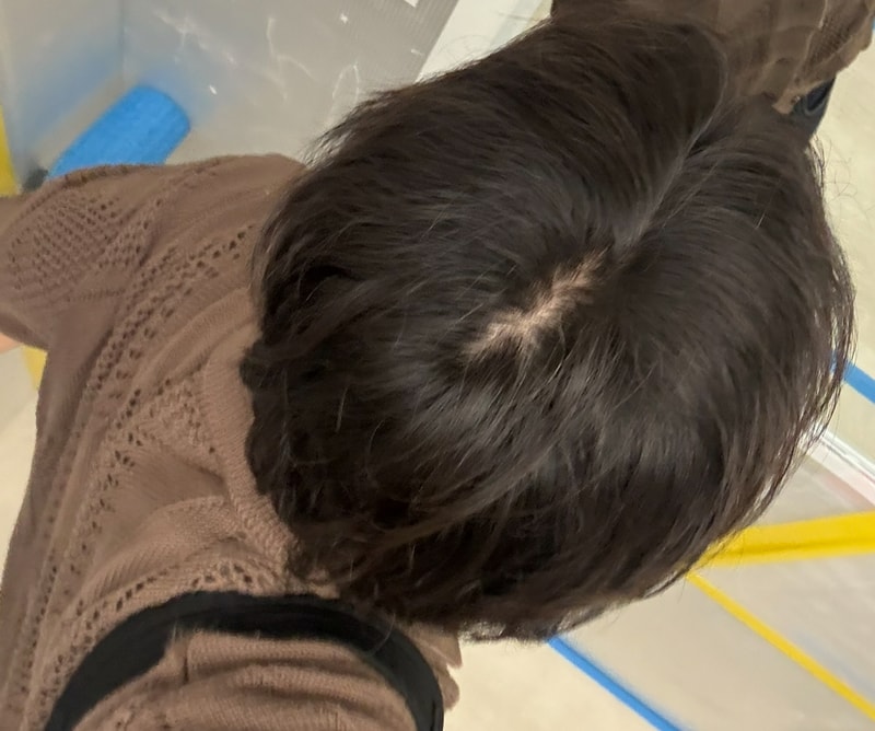 プロフェッシア1ヶ月半体験談