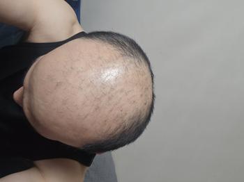 지금 상태입니다.