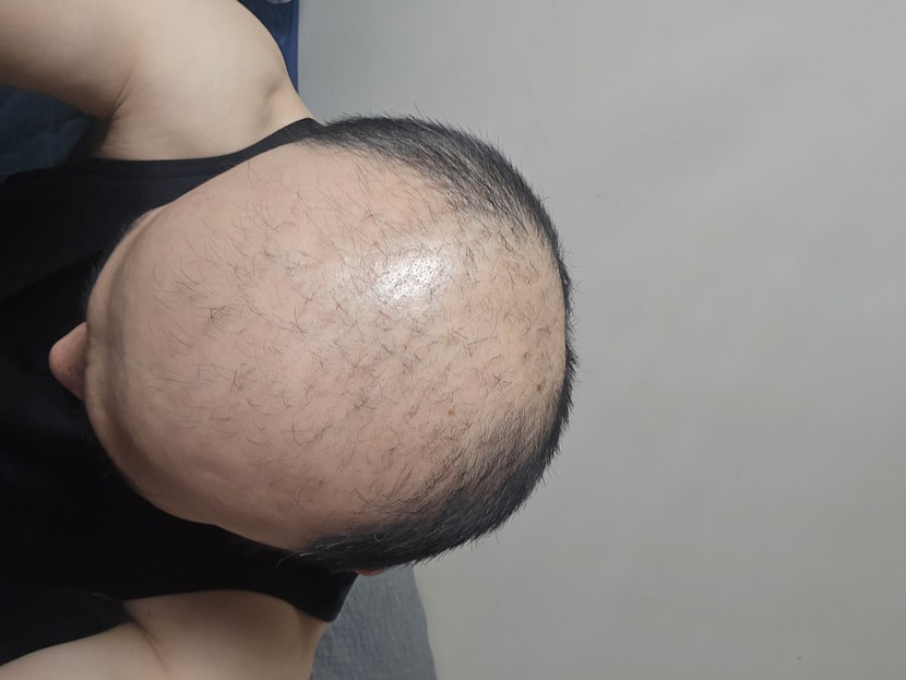 지금 상태입니다.