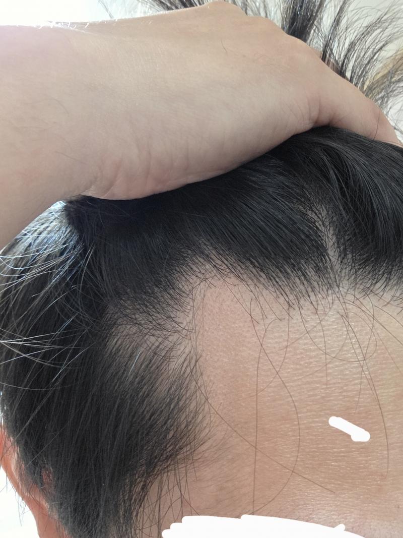 M字の中期から進んでいるようです。