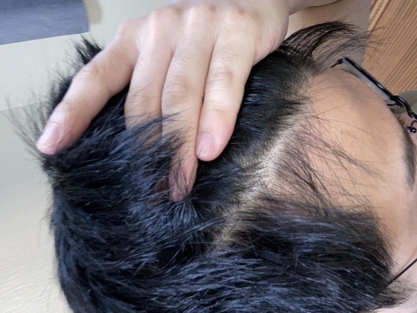가르마