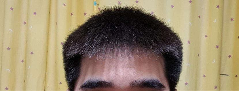 23년 7월 15일 앞머리 내리고 찍음