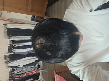약복용 2주차