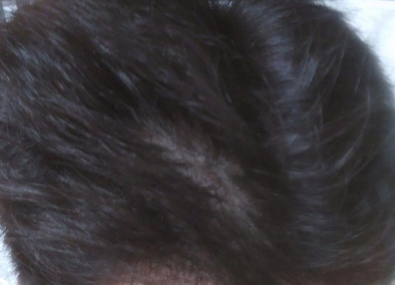 머리빠짐이 멈추질않는데 진짜어떡하죠