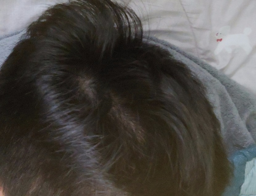 측두부