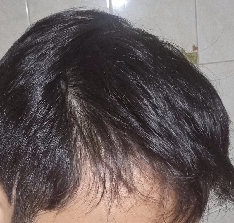 本当にこれからはどうすれば良いか分からないですね···