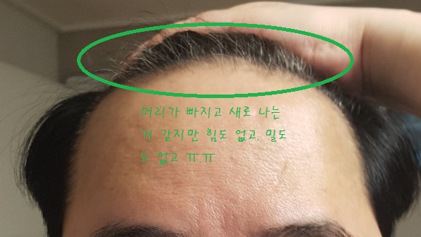 두타 두달 20일