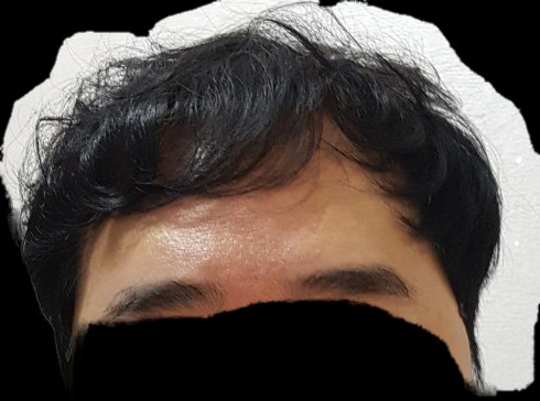 복용4개월째