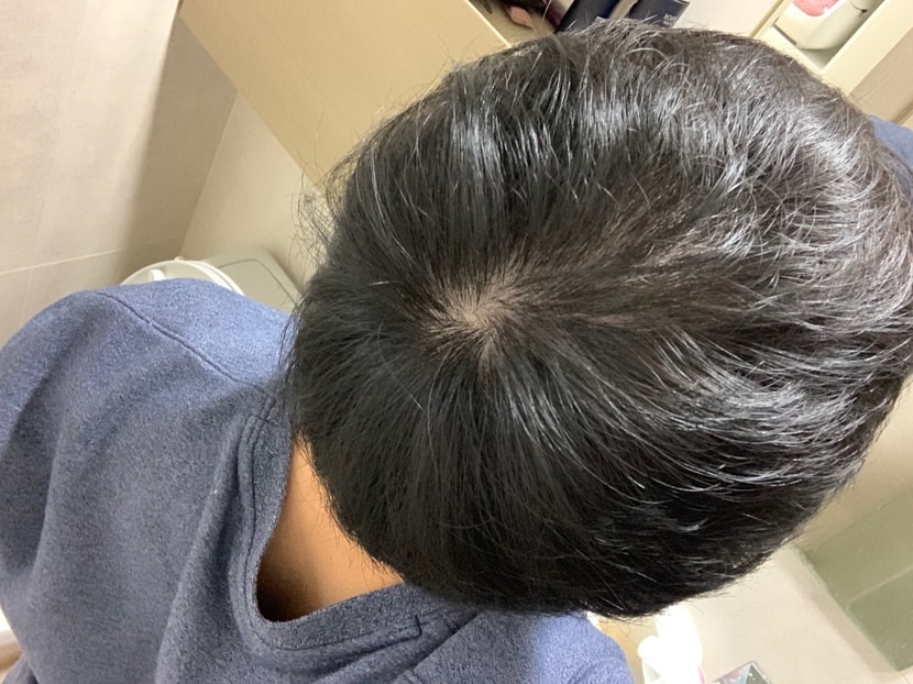 정수리 기준으로 사진 찍은 경우 입니다.