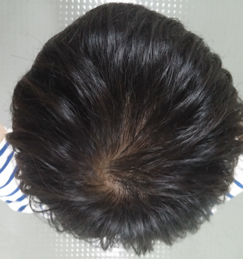 20140714