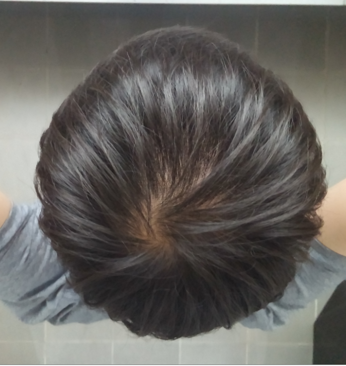 20140630