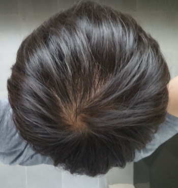 20140707