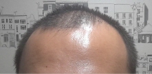 이마