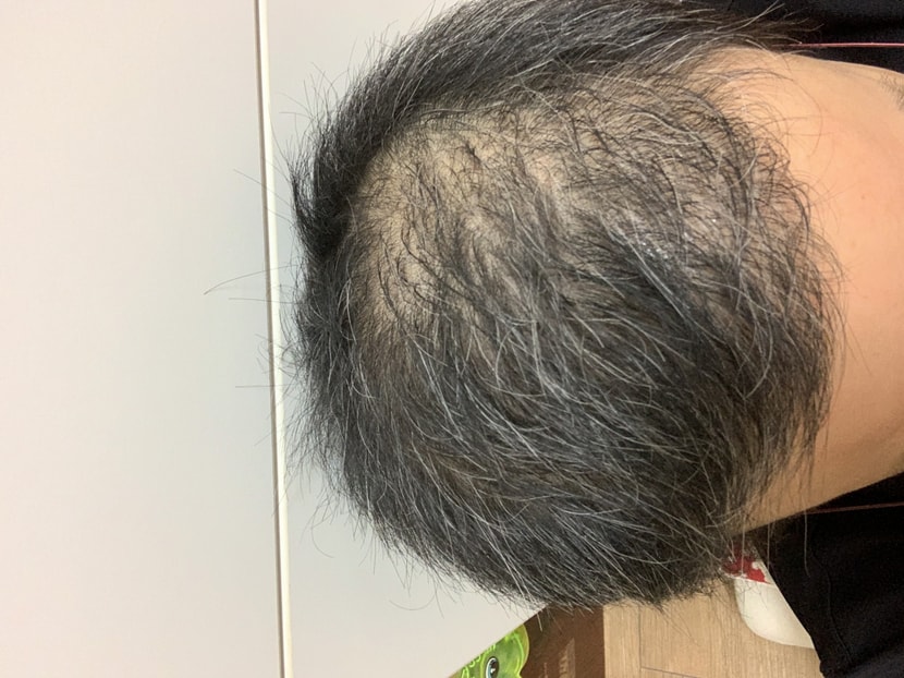 After