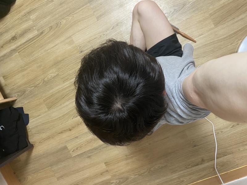 프로페시아 2년차