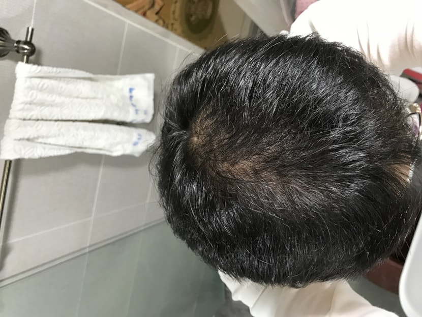 최근 사진