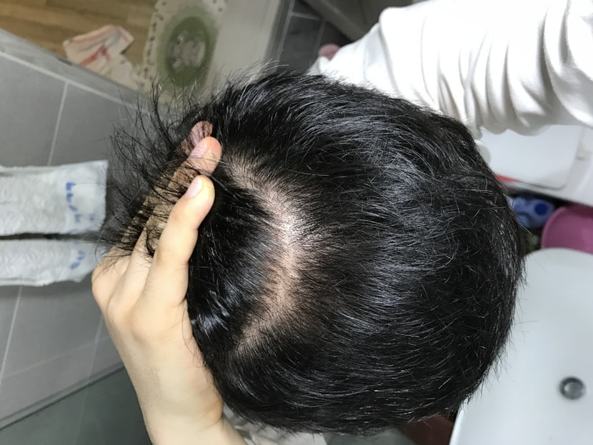 최근사진