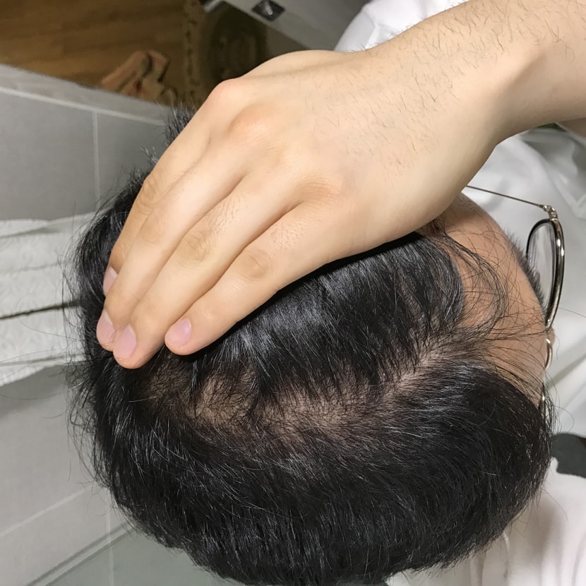 최근 사진