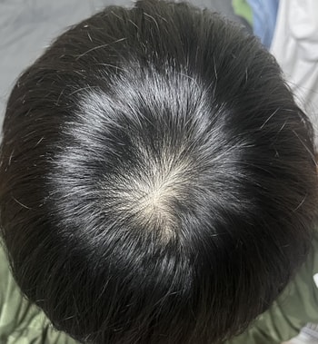 현재 상태입니다
