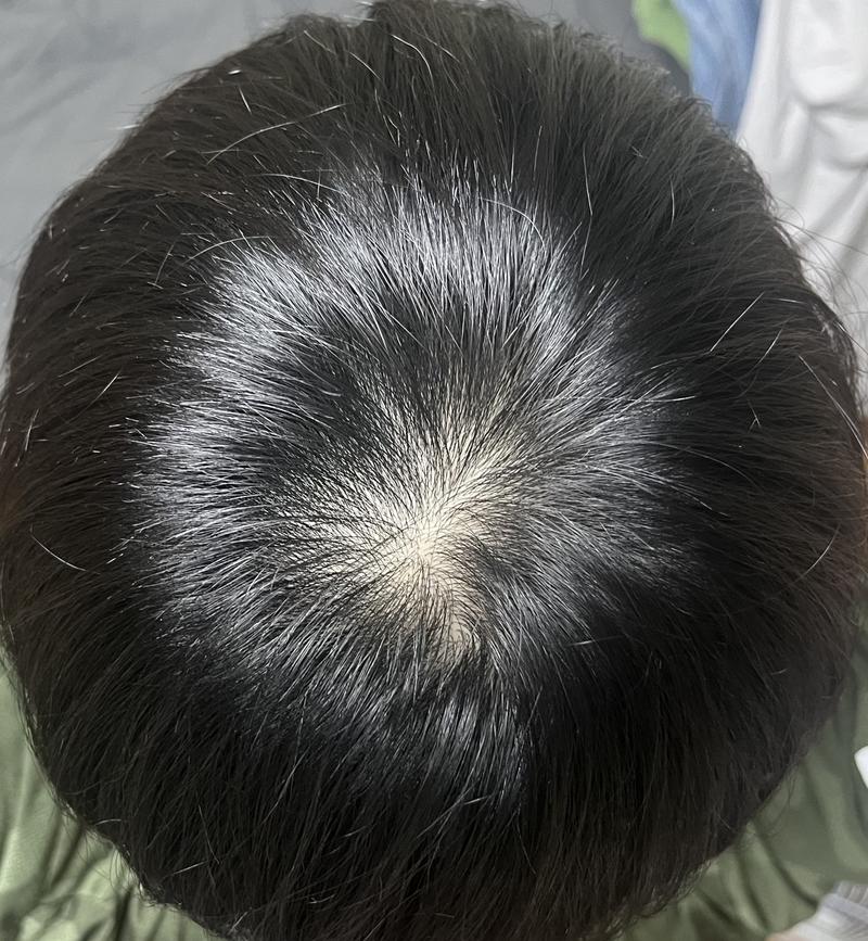 8ヶ月ほど観察しましたが、薄毛がで合っていますか？