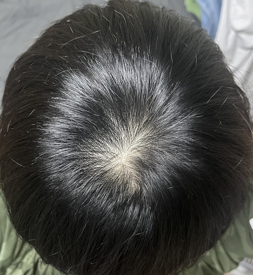 현재 상태입니다