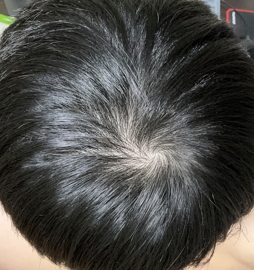 8개월 전 사진입니다.