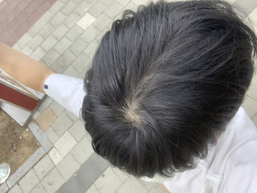 6개월차 야외 