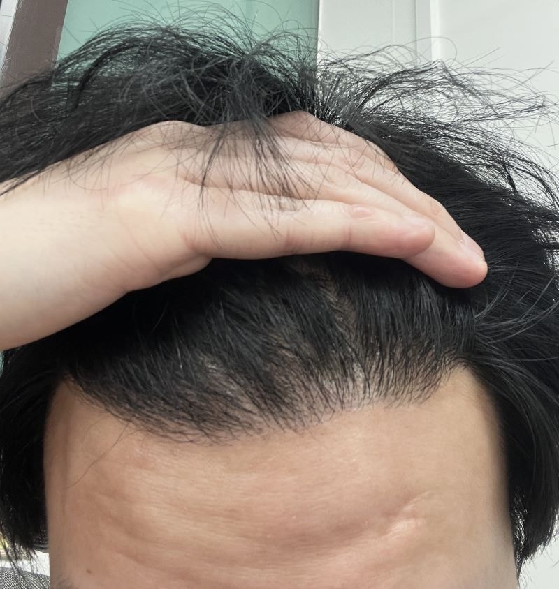 7개월차