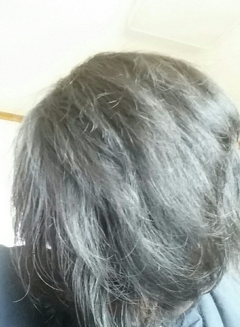 지금