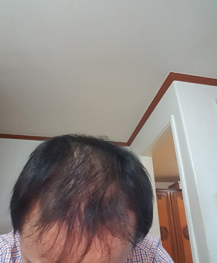 4개월차 후기 올립니다. 로게인폼. 소소한 즐거움