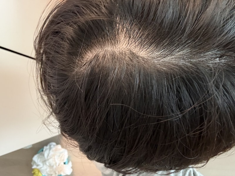 Am I losing hair?