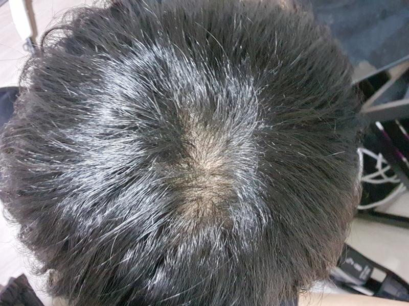 약을 먹어도 효과가 있는지 잘모르겠습니다.