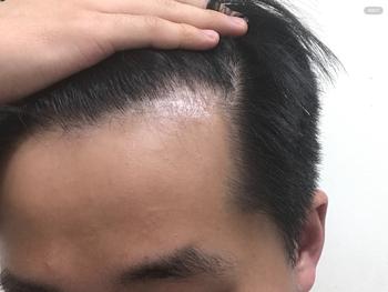 옛날사진1 -202303