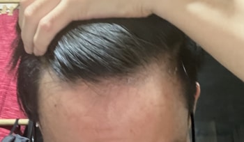 현재 머리 상태