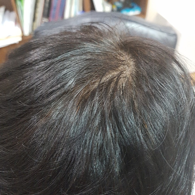 두타1달 10일